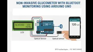 HVS-4592. Non-Invasive Glucometer with Bluetooth monitoring using Arduino UNO #NonInvasiveGlucometer