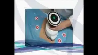 Безоперационная липосакция UltraShape V3 в Санкт-Петербурге