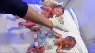 Why Preemies Are So Resilient | A Surprising Discovery in Low Birth Weight Twins#NICUBaby