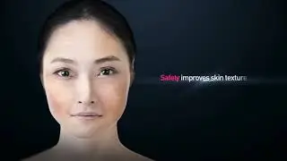 PicoLO Genuine Ultra-stable, High Power Picosecond Laser