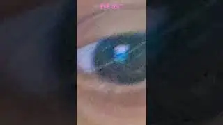 EyE tEsT
