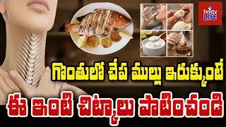 What to do if a fish bone is stuck in your throat? | Simple Home Remedies for Fish Bone | To The ...