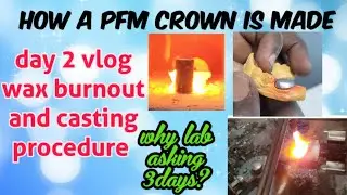 how a PFM crown is made || wax burnout and casting procedures day 2