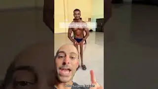 Атрофия ног из-за полиомиелита &mdash; он не пропускал день ног🙏