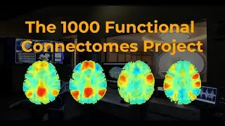 Open Science and the 1000 Functional Connectomes Project