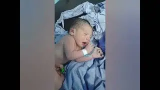 Cute newborn crying after delivery via C-Section in OR | Labour Room 