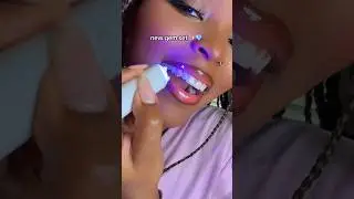 DIY tooth gems AT HOME ✨💎🦷 #toothgems #diy #style #shorts #tutorial #teeth #crafts #beauty #viral