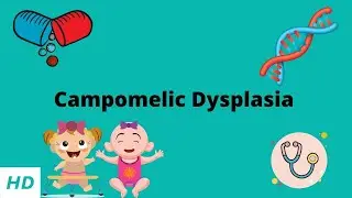 Campomelic Dysplasia, Causes, Signs and Symptoms, Diagnosis and Treatment.