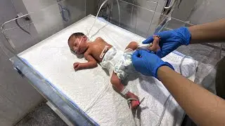 Newborn Baby Joint Physiotherapy | Gentle Movement Therapy for Healthy Growth 👶🩺 