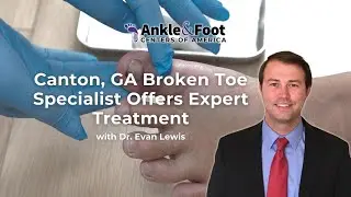 Canton, GA Broken Toe Specialist Offers Expert Treatment | Ankle & Foot Centers of America