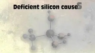 What Are The Silica Supplement Benefits?