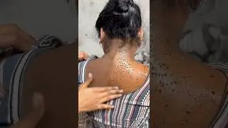 Dark Neck Cleaning Home Remedy | Remove Dirt & Tanning Instantly #shorts #skincare