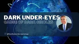 Cause of DARK CIRCLES UNDER THE EYES