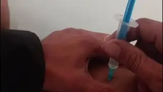 Im injection | intramuscular injection technique #viral #video #injection #short #trending #nursing