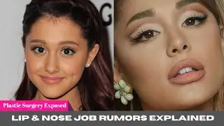 Ariana Grande Plastic Surgery EXPOSED &ndash; What She Changed Will Shock You | Glow Alert