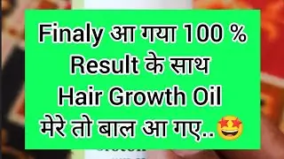 Finaly आ गया 100% Result wala hair growth Oil l🤩l Jamalgota for hair growth #jamalgotahairtreatment