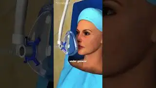 Gallbladder Removal Surgery 3D animation (Cholecystectomy) #music #motivation #epic #like