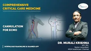 Critical Care Medicine | Cannulation for ECMO | Raaonline