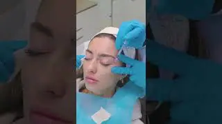 Unlock the Secret to Youthful Skin with Botox at Eden Aesthetic Clinic, Dubai