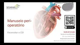 Manuseio perioperatório de pacemaker e CDI - parte 1