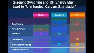 Medtronic Safety MRI REVO Video