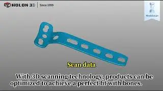 55 3D scanning can quickly replicate bone plates and generate highprecision models for optimized des