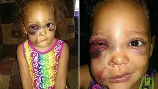 Mother Demands Answers For School's Coverup Of 'Playground Injury'