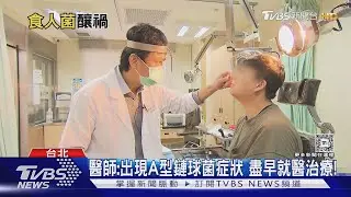 感染「A型鏈球菌」...醫師警告出現「這幾種症狀」...若輕忽 致死風險高!｜十點不一樣20240924 @TVBSNEWS02