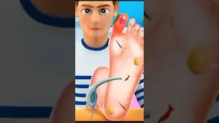 Foot Care# Visit Doctor Clinic#Game addicts #100kview