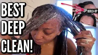 How $20 Got The BUILD-UP Out My Locs. MUST TRY! | Best Detox Combo PERIODT.