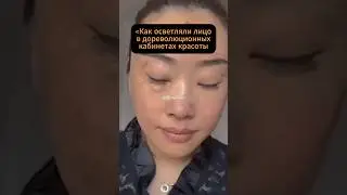 &laquo;Средство от пятен, которым пользовались до кремов и кислот&raquo; #здоровье