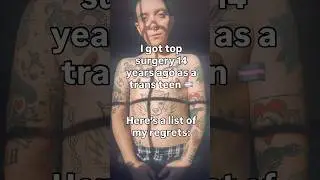 #Transgender 14 Years Post Top Surgery, My Regrets: