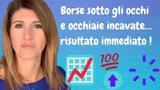 ✅BORSE SOTTO GLI OCCHI E OCCHIAIE INCAVATE risultato immediato