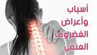 ما أسباب الإنزلاق الغضروفي العنقي؟