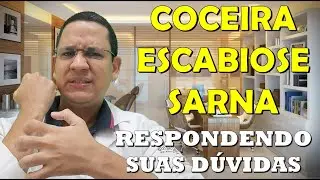 Tire todas as suas dúvidas sobre Escabiose, Sarna e Coceiras em geral.