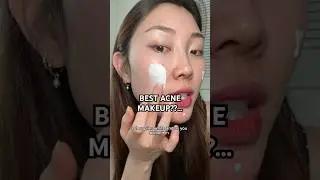 BEST BREATHABLE MAKEUP FOR ACNE... 😩🤲🏻 #makeup #acne