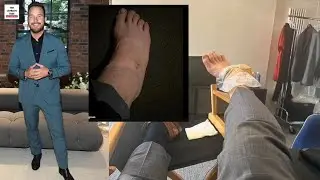 Chris Pratt Hurts Foot, Does His Own Stunt. Mercy