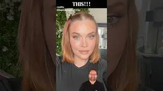 Face Lift + Brow Lift + Upper Blepharoplasty in Turkey | Surgeon Reacts