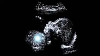 Canaan - Pro Life ft. Nick Fuentes