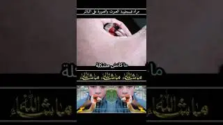 شاهد وتمتع مع قوة قوة قوة قوة قوة قوة  تتكلم في المدرسة تتعلم  مع الحسون القسنطيني الاصيل2026