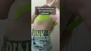 фиксация ребер / грудной клетки