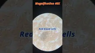 Blood under the microscope, microscope me blood khoon ll #shorts #microscope #youtubeshorts #blood
