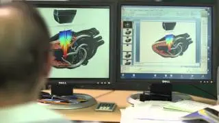 XDI Imaging Technology on the All New X-Porte Ultrasound Kiosk From Sonosite