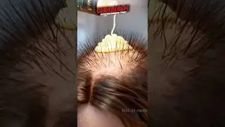 Индийский шампунь для мгновенного роста волос 🔥