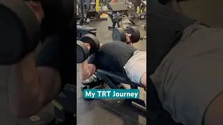 My TRT Journey (2 Years on Testosterone Replacement Therapy)