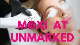 Top Arizona Med Spa Talks About Moxi by Sciton! ￼