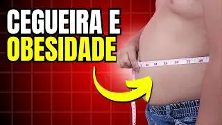 Síndrome de Bardet Biedl - Cegueira Com Obesidade