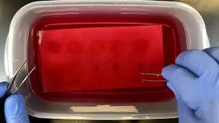 Sudan Red Test for Lipids
