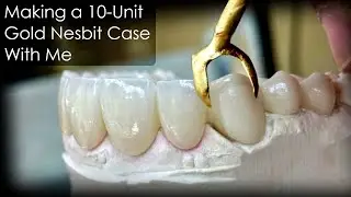 Make a Gold Nesbit, 10-Unit Case with Me