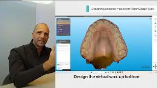 How to create mock-ups and 3D printed models with the iTero&trade; Design Suite